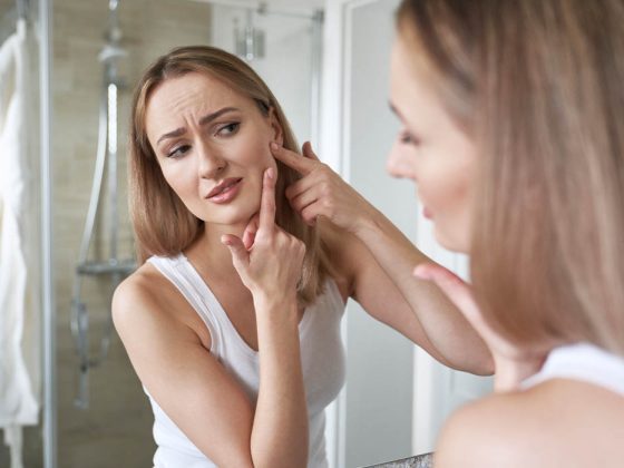 Conheça as principais causas da acne e os tratamentos recomendados