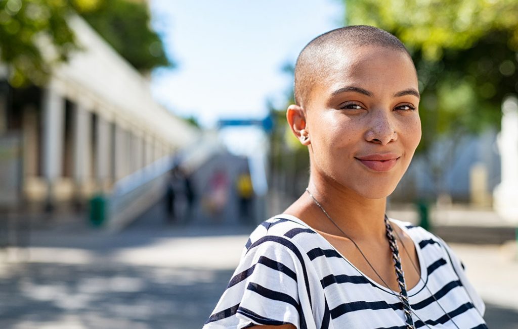 Calvice: Anvisa não recomenda tratamento com minoxidil por via oral